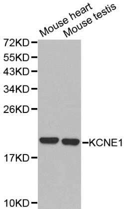 Anti-KCNE1 Antibody