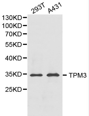 Anti-TPM3 Antibody