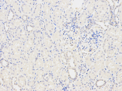 Anti-TPM3 Antibody Anti-TPM3 Antibody