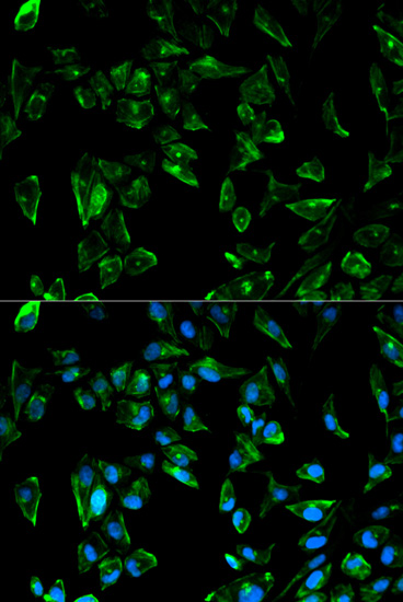 Anti-TPM3 Antibody Anti-TPM3 Antibody