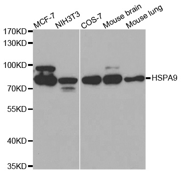 Anti-GRP75 Antibody