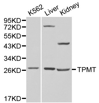 Anti-TPMT Antibody