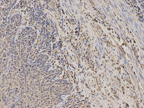 Anti-TPMT Antibody Anti-TPMT Antibody