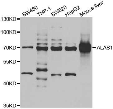 Anti-ALAS1 Antibody