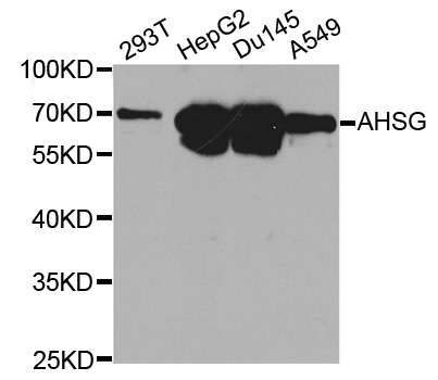 Anti-AHSG Antibody