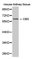 Anti-CBS Antibody