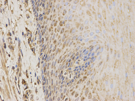 Anti-CBS Antibody Anti-CBS Antibody