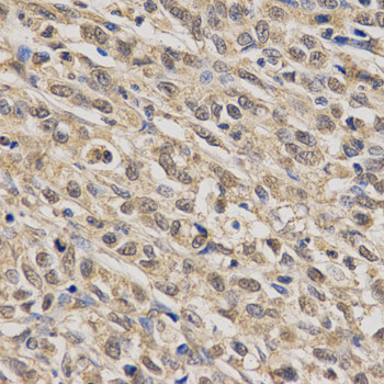 Anti-SCARB1 Antibody Anti-SCARB1 Antibody