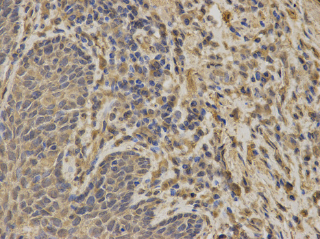 Anti-G6PD Antibody Anti-G6PD Antibody