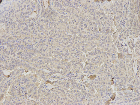 Anti-HLA-DRA Antibody Anti-HLA-DRA Antibody