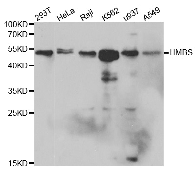 Anti-HMBS Antibody