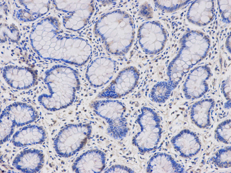 Anti-HMBS Antibody Anti-HMBS Antibody