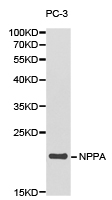 Anti-NPPA Antibody