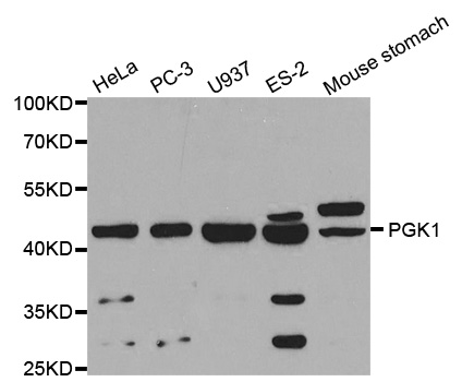 Anti-PGK1 Antibody