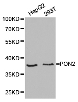 Anti-PON2 Antibody