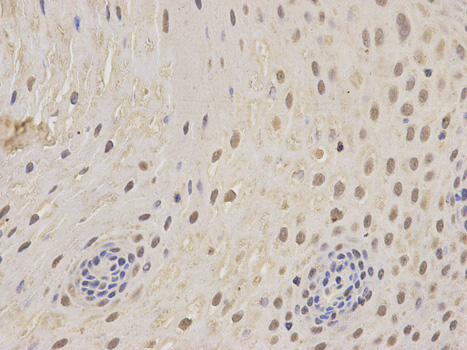Anti-PSMC5 Antibody Anti-PSMC5 Antibody