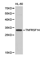Anti-TNFRSF14 Antibody