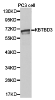 Anti-KBTBD3 Antibody