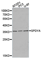 Anti-SPDYA Antibody
