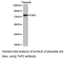 Anti-TAP2 Antibody