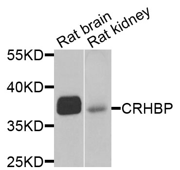 Anti-CRHBP Antibody