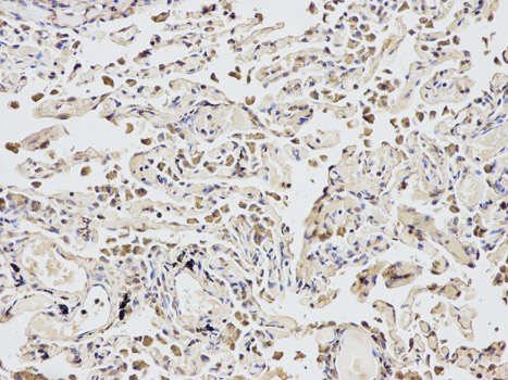 Anti-eIF4A1 Antibody Anti-eIF4A1 Antibody