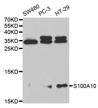 Anti-S100A10 Antibody