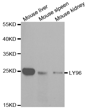 Anti-LY96 Antibody