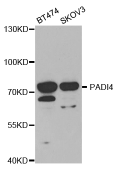 Anti-PADI4 Antibody
