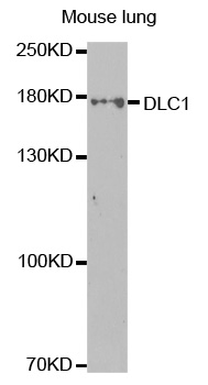 Anti-DLC1 Antibody
