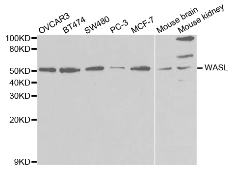 Anti-WASL Antibody
