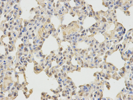 Anti-WASL Antibody Anti-WASL Antibody