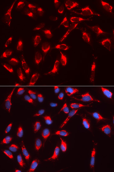 Anti-WASL Antibody Anti-WASL Antibody