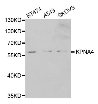 Anti-KPNA4 Antibody