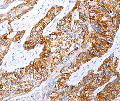 Anti-GRPR Antibody Anti-GRPR Antibody