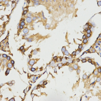 Anti-LRPAP1 Antibody Anti-LRPAP1 Antibody