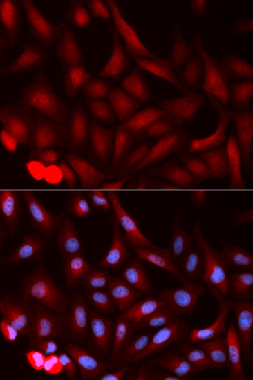 Anti-PSME1 Antibody Anti-PSME1 Antibody