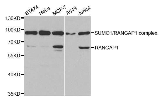 Anti-RANGAP1 Antibody