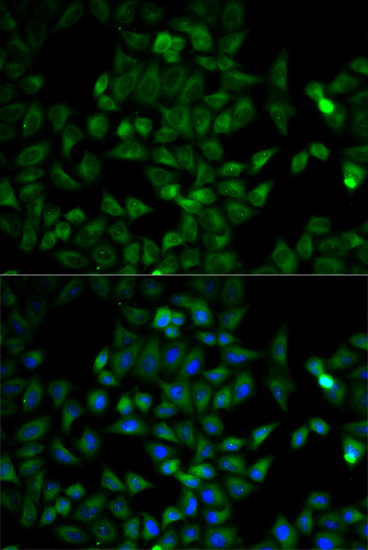 Anti-TPI1 Antibody Anti-TPI1 Antibody