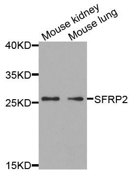 Anti-SFRP2 Antibody