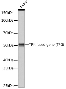Anti-TRK fused gene Antibody [ARC1882]