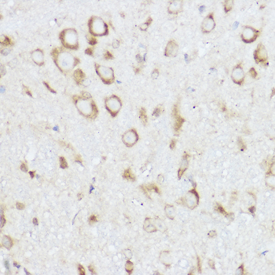 Anti-NEURL1B Antibody Anti-NEURL1B Antibody