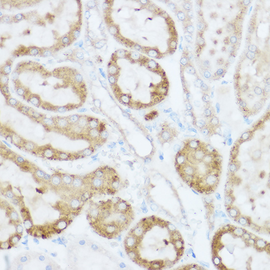 Anti-NEURL1B Antibody Anti-NEURL1B Antibody