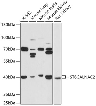 Anti-ST6GALNAC2 Antibody