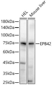 Anti-EPB42 Antibody