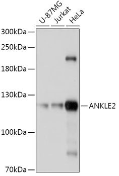 Anti-ANKLE2 Antibody