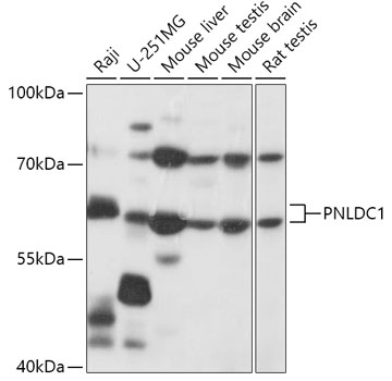 Anti-PNLDC1 Antibody