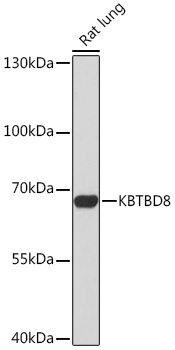 Anti-KBTBD8 Antibody