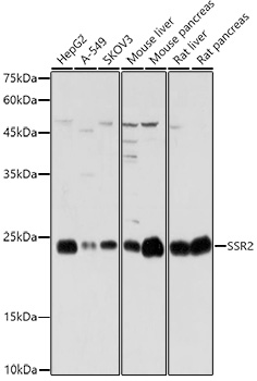 Anti-SSR2 Antibody