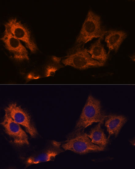 Anti-SMAP1 Antibody Anti-SMAP1 Antibody